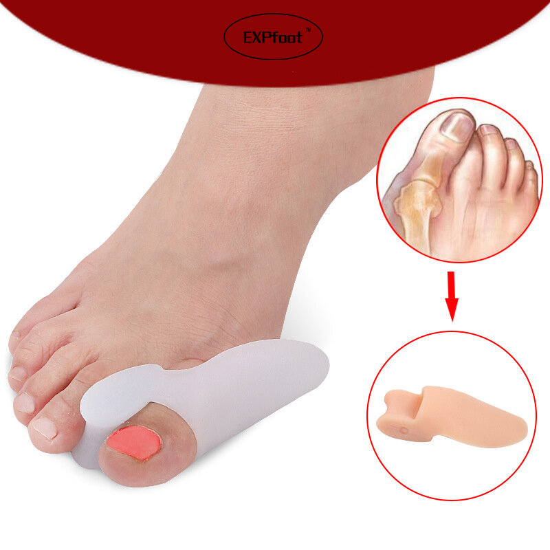 1 pairs Hot saleHallux valgus correction daily spot a large number of wholesale appliance care insole insole toe Free shipping