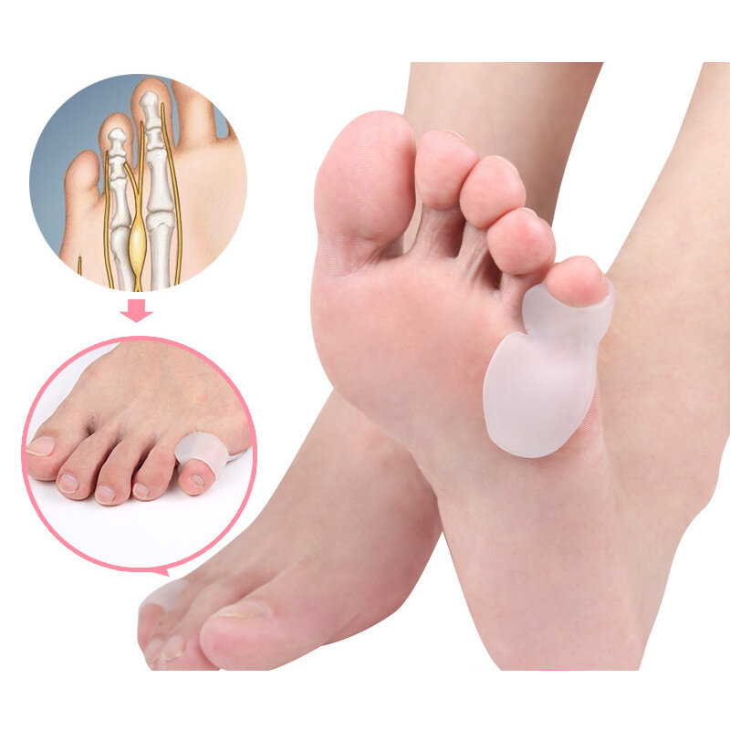 4Pcs=2Pairs Little Finger Spreader Foot Care Straightener Guards Hammer Protector Bunion Hallux Valgus Toe Separator Pain Relief