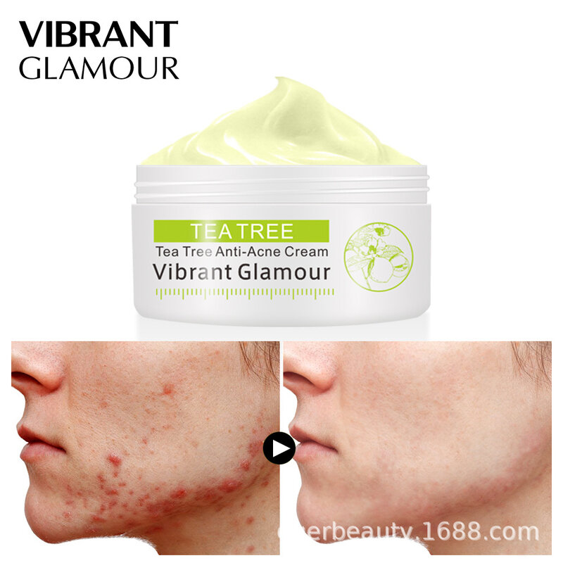 Vibrante glamour chá árvore acne creme anti-acne impressão rosto creme removedor acne tratamento facial elimina o controle de óleo cuidados com a pele