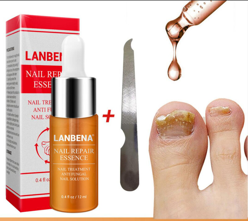 LANBENA مسمار إصلاح مستخلصات الأظافر الفطرية العلاج إزالة فطار اصبع القدم مسمار مغذية اشراق اليد و العناية بالقدم