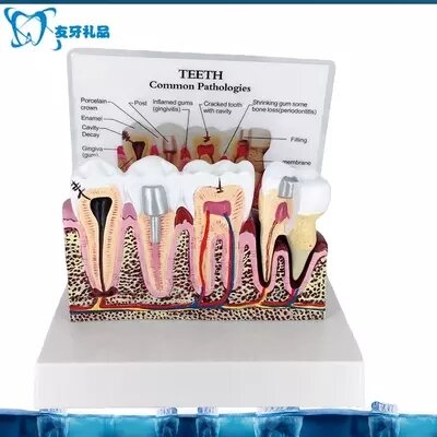 Modelo anatômico dental livre compras