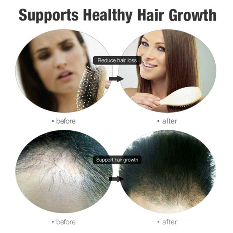 100% Hair Loss Liquid Care Beauty Dense Hair Growth Serum Fast Hair Growth Essence Oil Help Growth Stop Hair Loss TSLM2