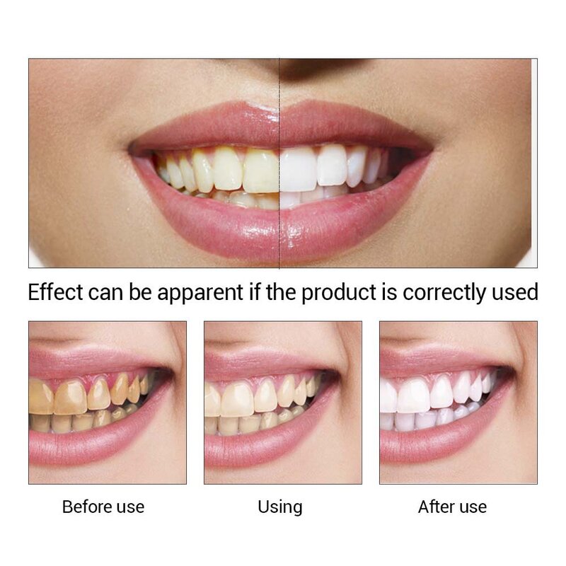 LANBENA dientes blanqueamiento polvo de esencia gel de limpieza e higiene bucal cuidado de los dientes suero elimina la placa Manchas diente Blanqueador