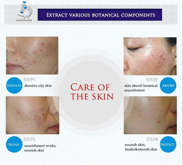 Nieuwe gezichtscrème whitening huidverzorging anti acne behandeling crème olie controle Hydraterende Acne Litteken Remover Poriën bioaqua acne crème