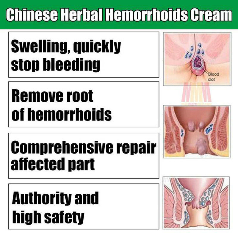 Травяное средство для эффективного лечения внутреннего геморроя Hua Tuo, сваи внешней анальной трещины