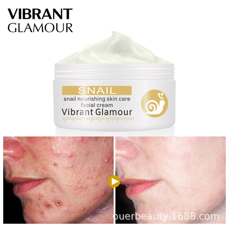 VIBRANT GLAMOUR Tea Tree – crème pour le visage, Anti-acné, traitement de l'acné, contrôle du sébum, soins pour la peau