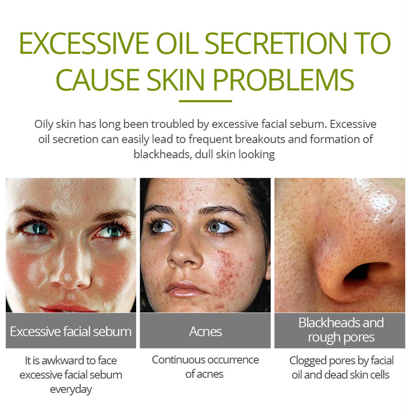 LEVENDIGE GLAMOUR Tea Tree acne crème Anti-acne print Gezicht crème remover acne behandeling Elimineert Olie controle Huid zorg