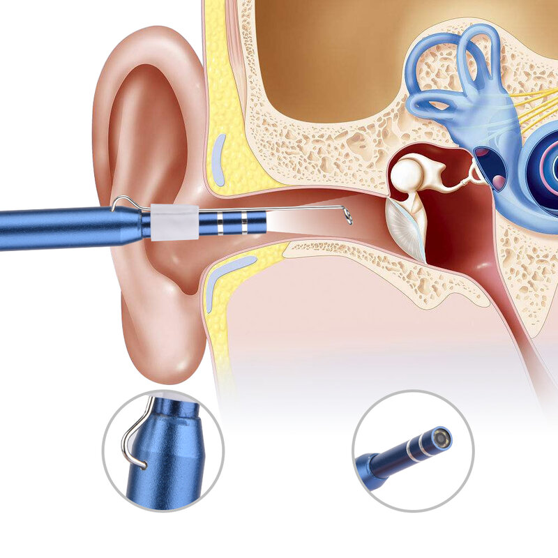 Endoscópio de limpeza da orelha 2 in1 usb hd visual colher de ouvido 5.5mm mini câmera android pc orelha picareta ferramenta borescope cuidados de saúde