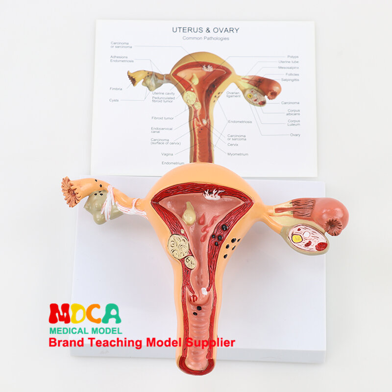 Medische Onderwijs van Pathologische Baarmoeder Reproductieve Model voor Gezinsplanning Baarmoeder Reproductieve Anatomie Model MSZXT001