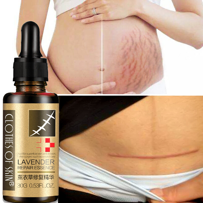 2PCS Lavender Essential Massage Oil Stretch Marks Scar Removal Oil For Pregnant Women Hyaluronic Acid Serum Scar Removal Cream