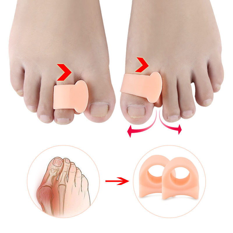 2 peças separador de dedos de silicone, aparelho ortopédico externo de sobreposição de hálux, corretor de valgus em dedos, ferramentas de cuidados com os pés