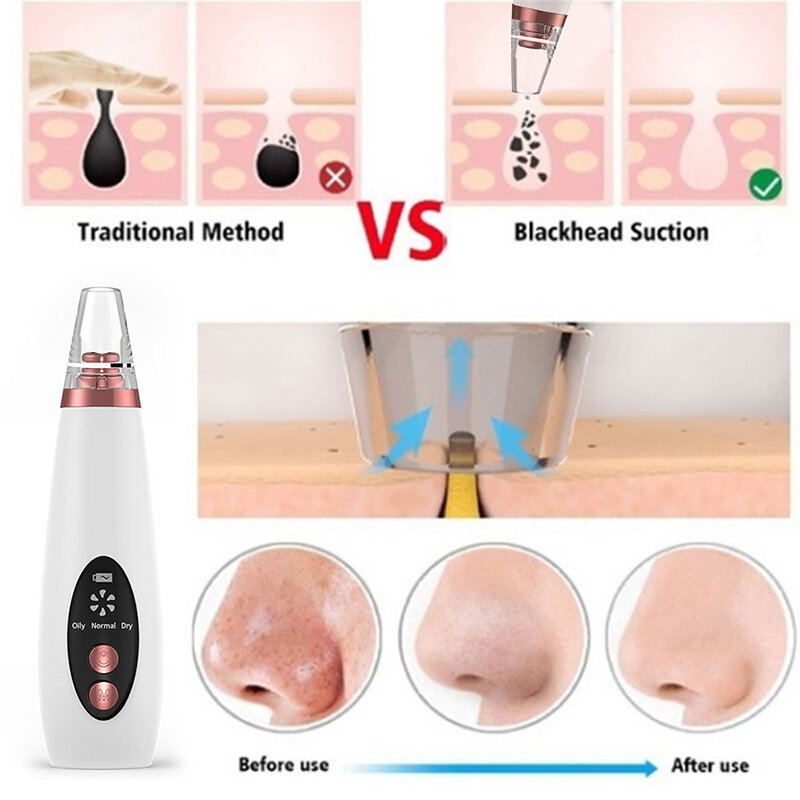 Limpiador de poros Blackhead removedor de vacío para el cuidado de la piel succión Black head negro puntos negros granos de limpieza profunda de la herramienta