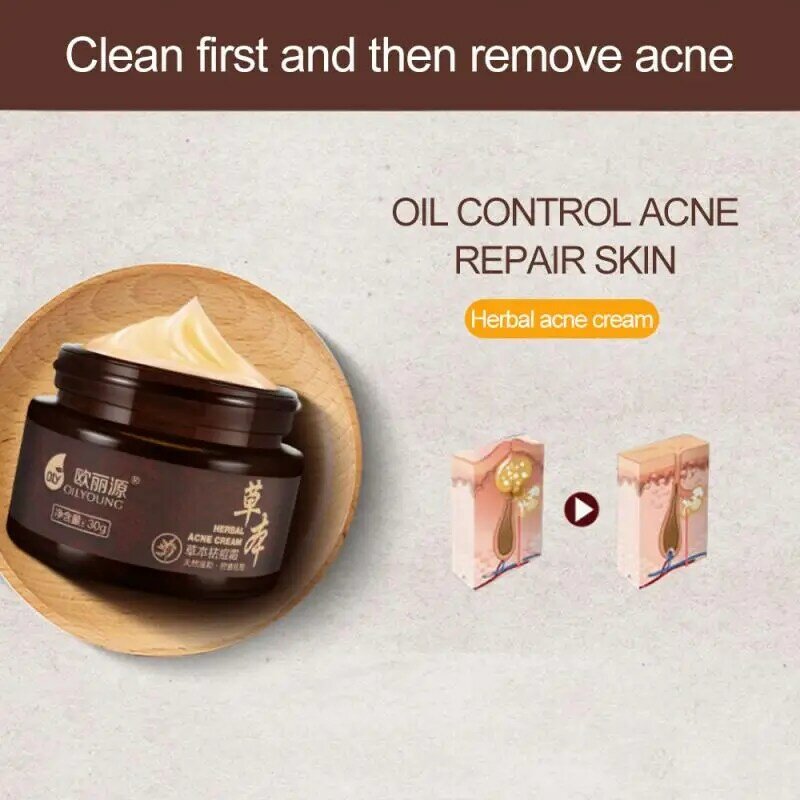2021 Remove black head anti acne oil control cream Organic herbaceous substances Beauty Moisturizing treatment acne Repair Cream