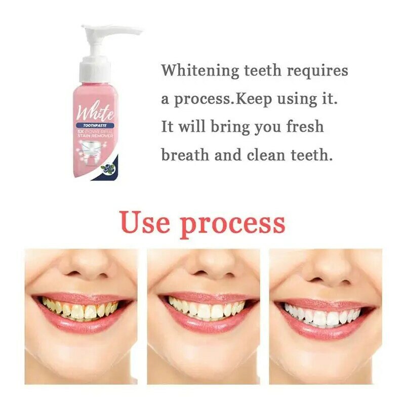 Toothpaste Stain Smoke Coffee Removal Reduce Tooth Fresh Gums Fight Whitening Bleeding Toothpaste Toothpaste Dirt K1E3