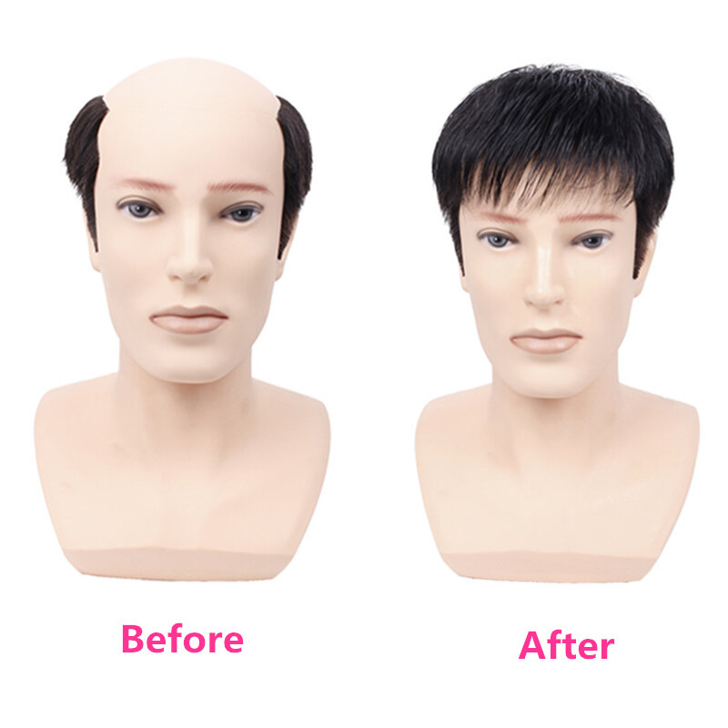 Halo Lady Beauty – toupet de cheveux humains épais avec PU autour du système de remplacement de cheveux, perruque de cheveux protiques pour hommes chauve