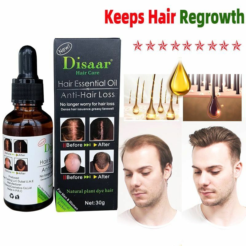 Folikel Memperbaiki Pertumbuhan Rambut Minyak Esensial Tanaman Cepat Anti-rambut Rontok Produk Serum Pertumbuhan Kembali Perawatan Kulit Kepala Rambut Menipis 30Ml