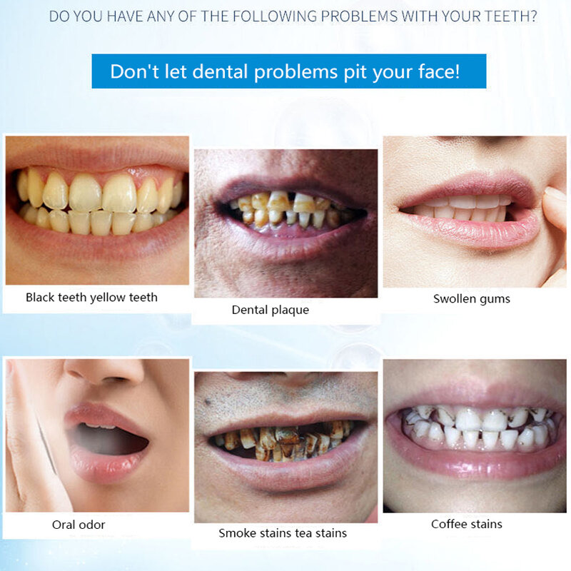 Dente branqueamento dente em pó 50g, remover manchas de fumaça, manchas de café, manchas de chá, refrescar o mau hálito, higiene oral, cuidados dentários