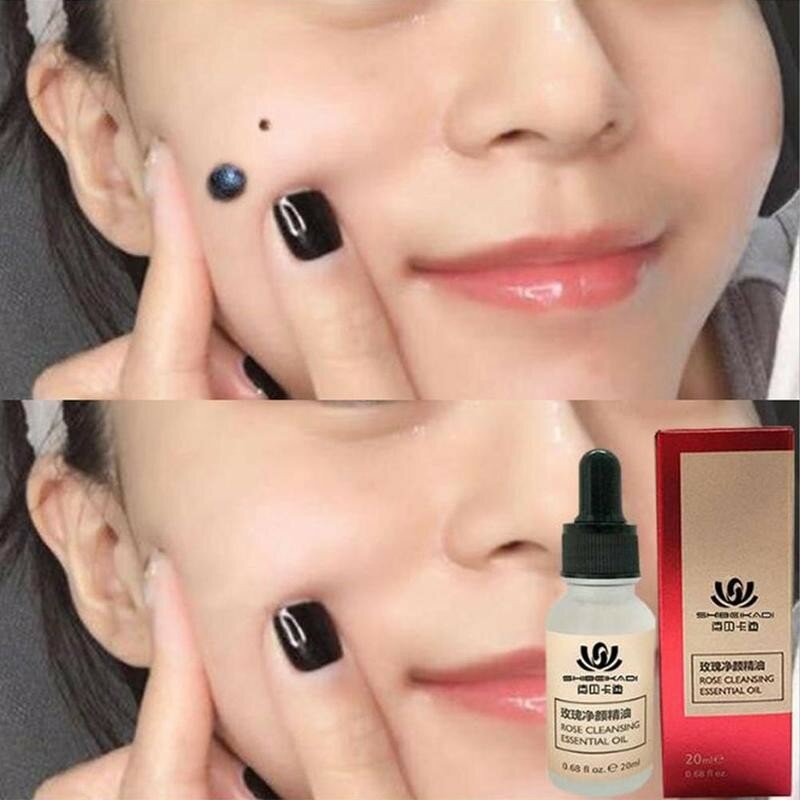 Mole & Skin Tag Removal Solution Mighty Tag Spots Remover Serum Painless Mole Skin Dark Spot Removal Freckle Removal Cream