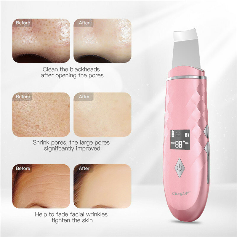 Ckeyin ultra sônico purificador da pele íon facial poros profundos limpeza acne cravo remoção do enrugamento peeling extrator clareamento da pele