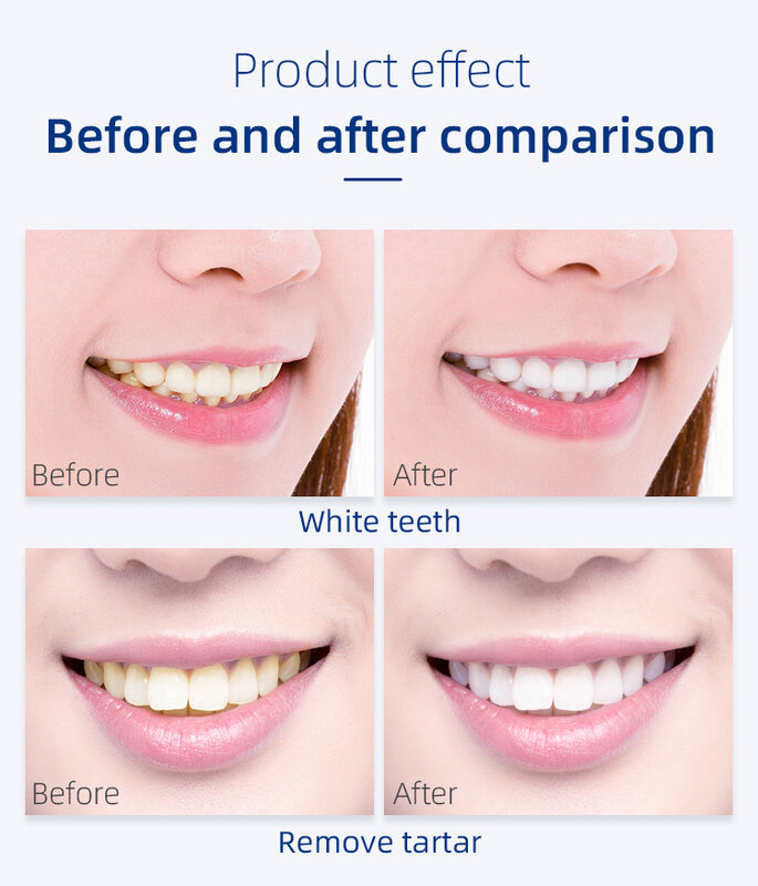 LED 치아 미백 장치, 치과 치료 건강 구강 관리 블루 라이트 치아 미백제 미용 도구