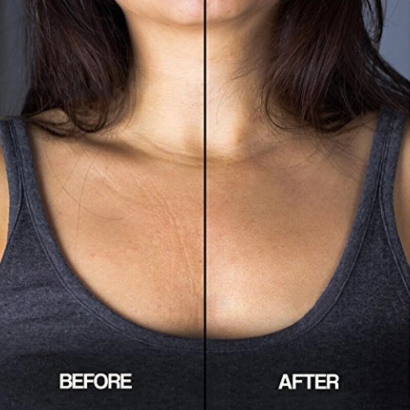 New Reusable Anti Falten Brust Pad Silikon Transparent Entfernung Patch Gesicht Hautpflege Anti Aging Brust Heben Brust Patch drop