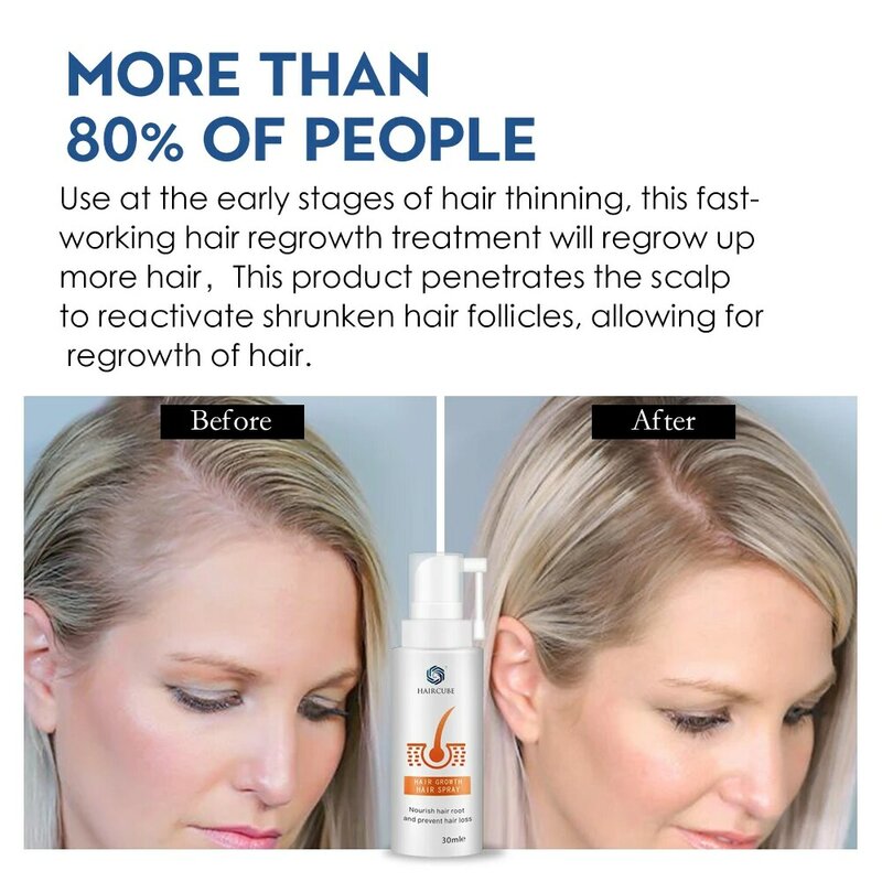 HAIRCUBE Hair Growth Products All Natural Spray for Hair Thickening Anti Hair Loss Treatment for Women Men Hair Growth Serum