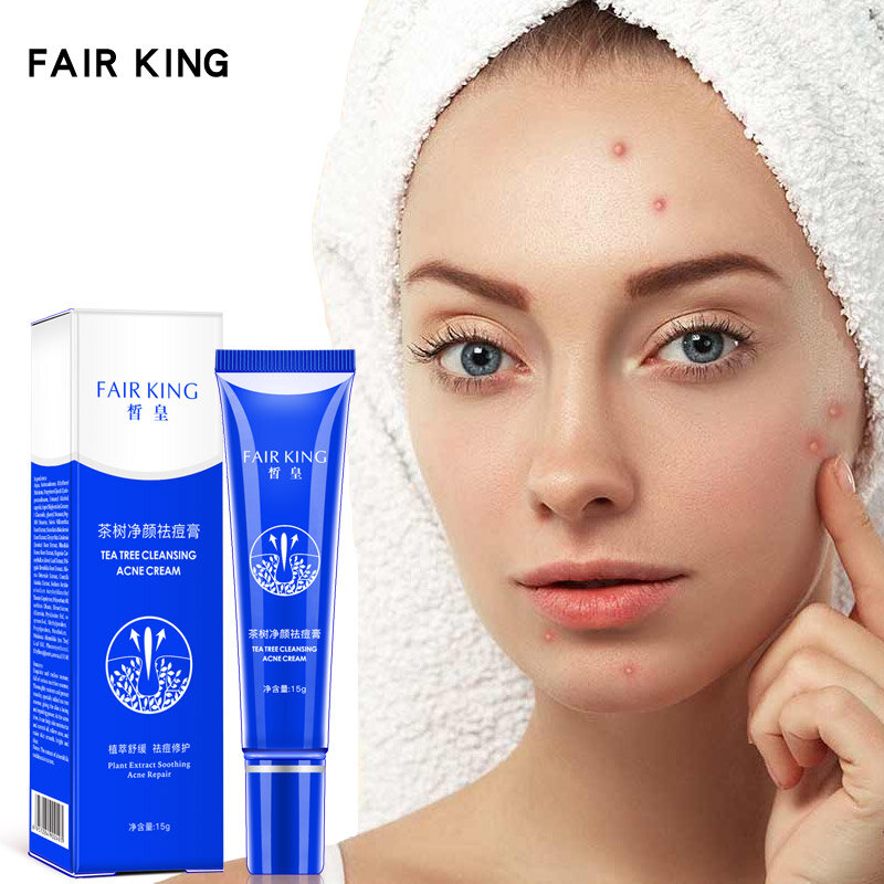 Creme de tratamento para acne, venda quente de creme de tratamento para acne e cicatriz, para cuidados com a pele do rosto, limpeza eficaz