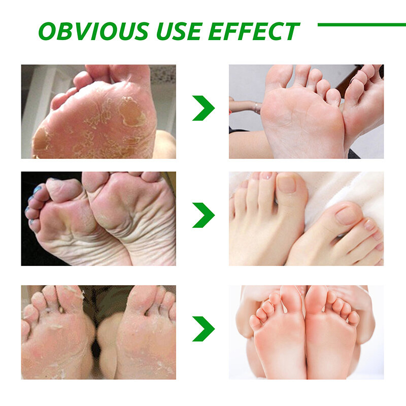 Aloe Vera หน้ากากเท้า Peeling สำหรับขาฟุตหน้ากาก Exfoliating ถุงเท้าขัดสำหรับ Pedicure Anti Crack Heel ลบผิวเท้า patch TSLM1
