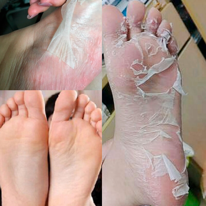 นาฬิกา LANBENA Exfoliating Foot Peel Mask เพียง One คู่ลบ Dead Skin อย่างทั่วถึง2-7วันหน้ากากเท้า peeling Cuticles Heel