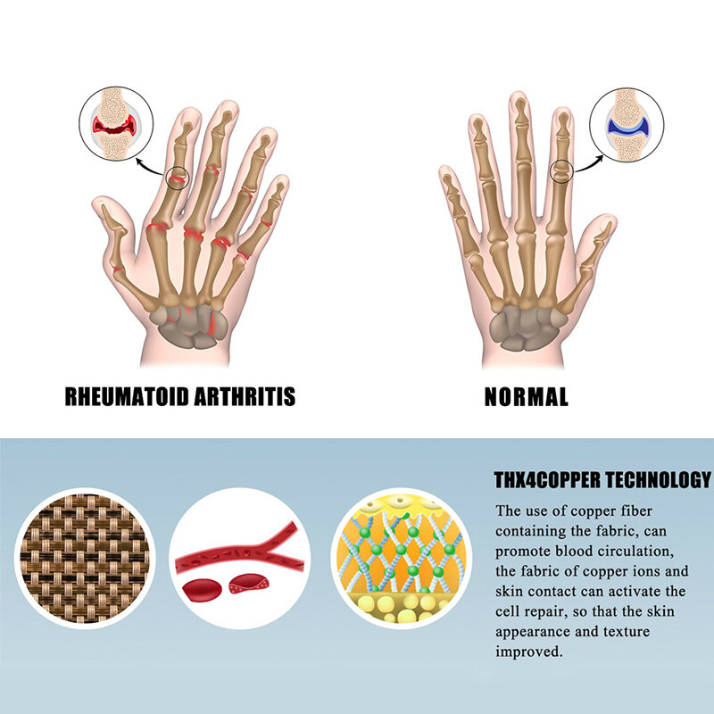 Перчатки компрессионные магнитные для женщин, перчатки против ревматоидного артрита, обезболивающие, для лечения пальцев, 1 пара