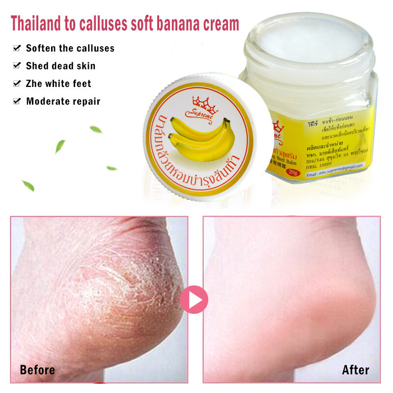Crema Natural de plátano para eliminar la piel muerta, crema de pies de reparación rápida, producto para el cuidado de la piel, crema antigrietas antisecado, TSLM2, 1 unidad