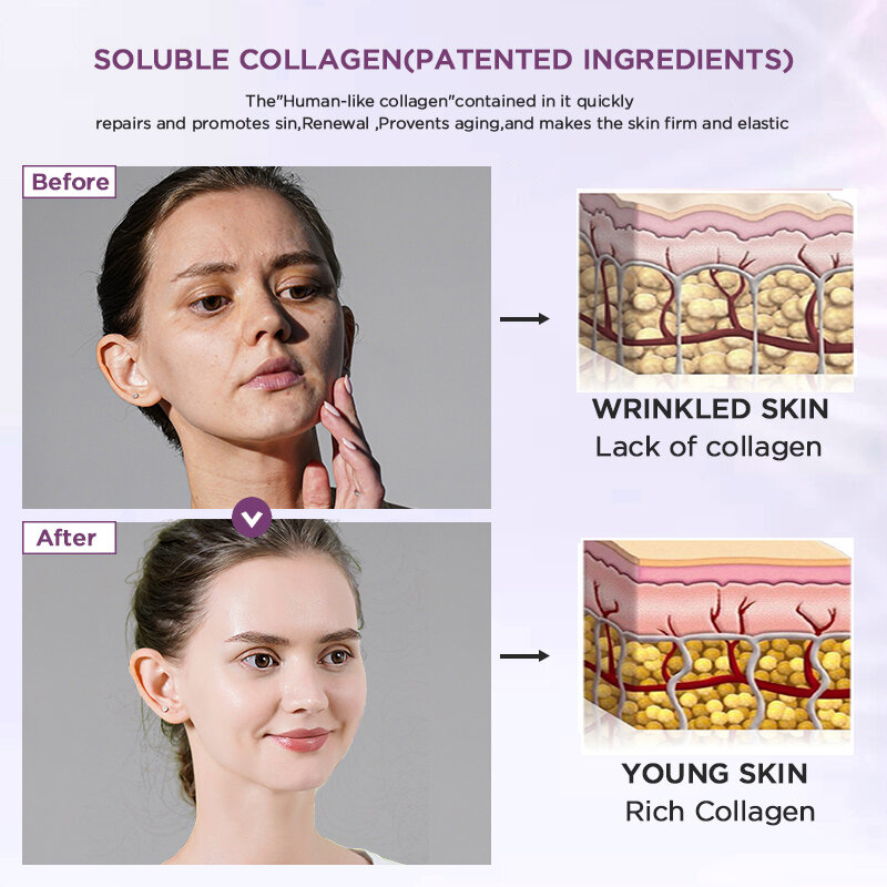 Andrebook-soro hidrolisado antienvelhecimento com colágeno, para firmamento facial, anti-rugas, melhora a essência da pele solta