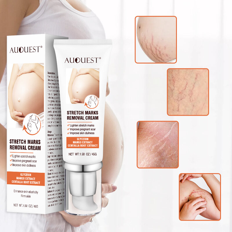 AUQUEST Stretch Marks Removal Cream Maternity Scar Acne Remover for Pregnant Women Anti-Aging Skin Firming Cream Body Care 45g