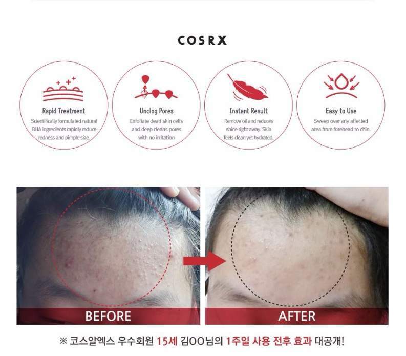 COSRX un paso Original claro Pad 70 unids/caja acné Remover cara máscara de acné del poro tratamiento profunda limpieza cuidado de la piel Corea cosméticos