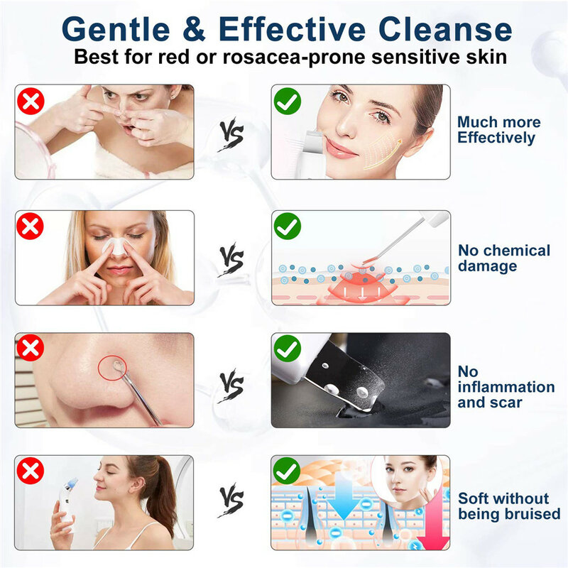 Ultrasonic Pore Cleaner เครื่องมือทำความสะอาดผิวหน้า Blackhead Removal อุปกรณ์ความงาม Pore ทำความสะอาด Personal Care