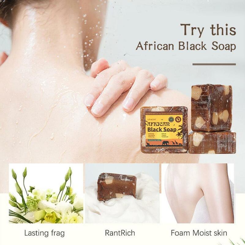 Jabón negro africano 100% Natural, tratamiento para el acné, belleza corporal, T4J2