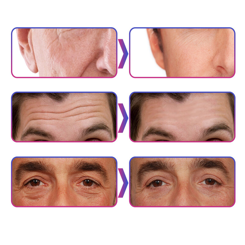 Männer Anti Aging Gesicht Creme Tiefe Feuchtigkeitsspendende Öl Steuerung Falten Haut Tag Straffende Anti Pflege Creme Aufhellung Hebe