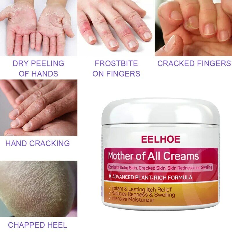 Crème hydratante pour la peau, pommade pour le traitement de la peau, traitement contre les démangeaisons, Massage corporel, Anti-démangeaison, 20ML