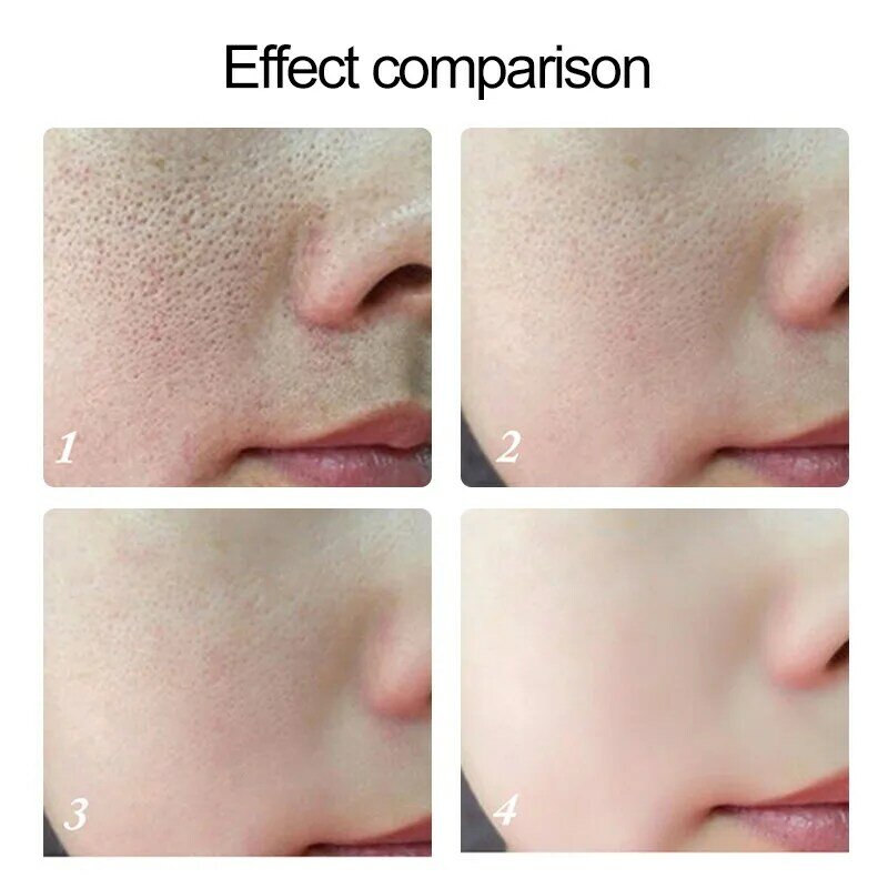 VENZEN Hyaluronsäure Feuchtigkeitsspendende Serum Schrumpfen Poren Erhellen Dunkle Flecken Anti-Aging Anti-Falten Bleaching Essenz Hautpflege