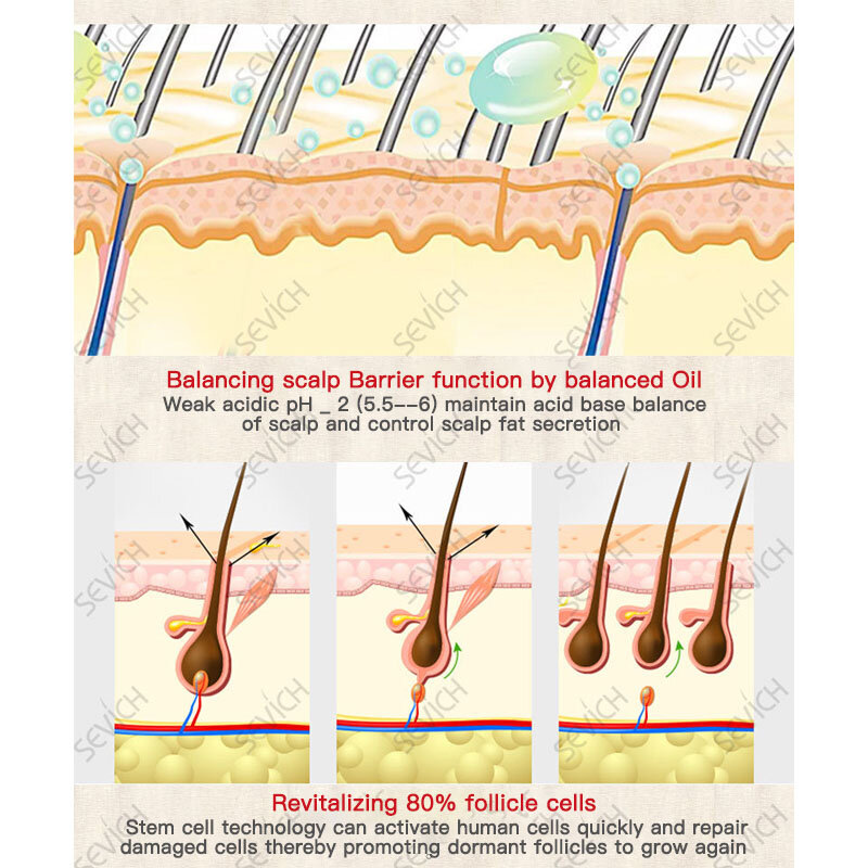 1PC Schnelle Haar Wachstum Spray Ingwer Extrakt Verhindern Haarausfall Helfen Haar Wachstum Haar Care Natürliche Mit Keine Seite effekte