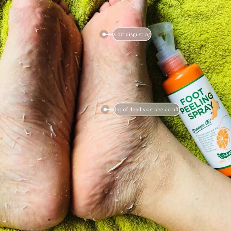 Prodotti per la cura della pelle Spray esfoliante per i piedi essenza Pedicure mano pelle morta Scrub maschera per i piedi sbiancamento cura dei piedi per bambini uomini e donne