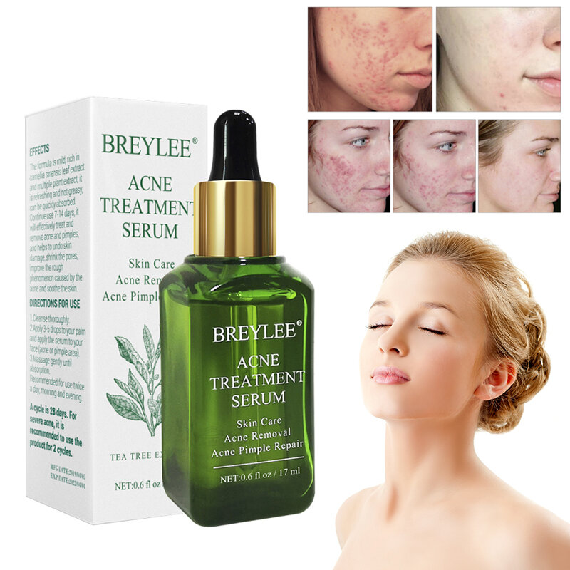 Breylee顔にきび治療血清顔傷跡にきび除去美白にきび削除にきびスキンヘルスケア製品
