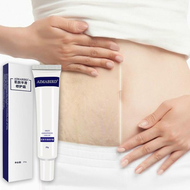 Crema de maternidad potente para eliminar cicatrices en el embarazo, cremas para estrías, tratamiento de reparación de Winkles, reafirmante corporal, Anti S9L6, 20g