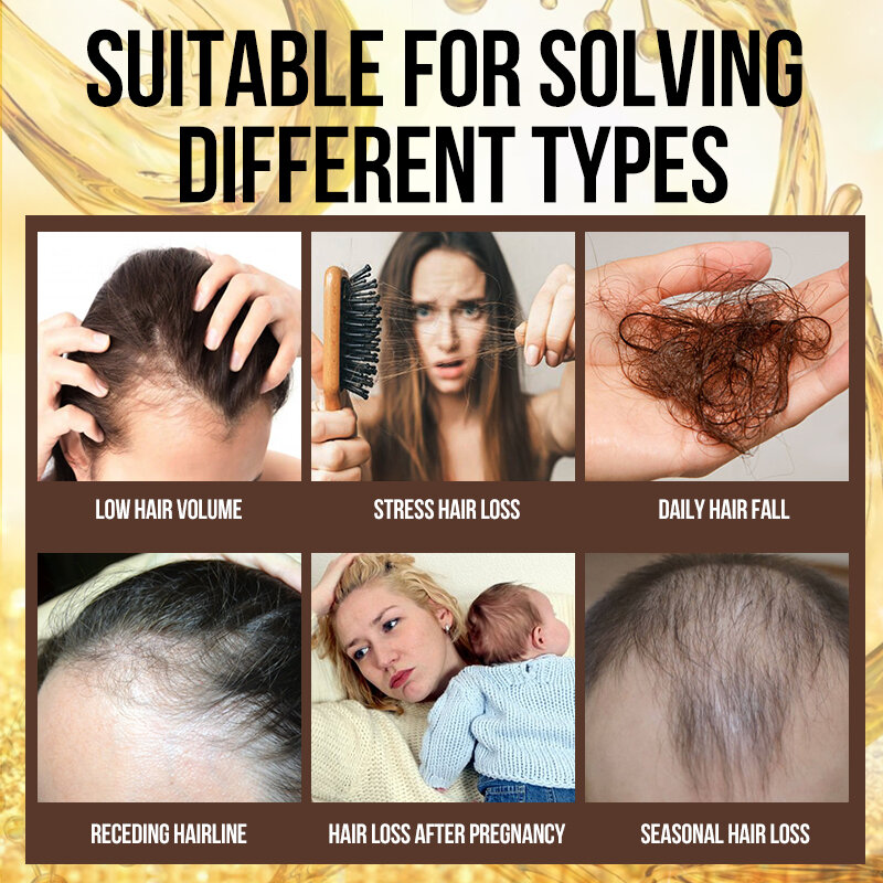 Essence de croissance de cheveux naturels, 10 pièces, Anti-perte de cheveux, produits de soin, repousse des cheveux, Massage du cuir chevelu, traitements à base d'huile pour hommes et femmes