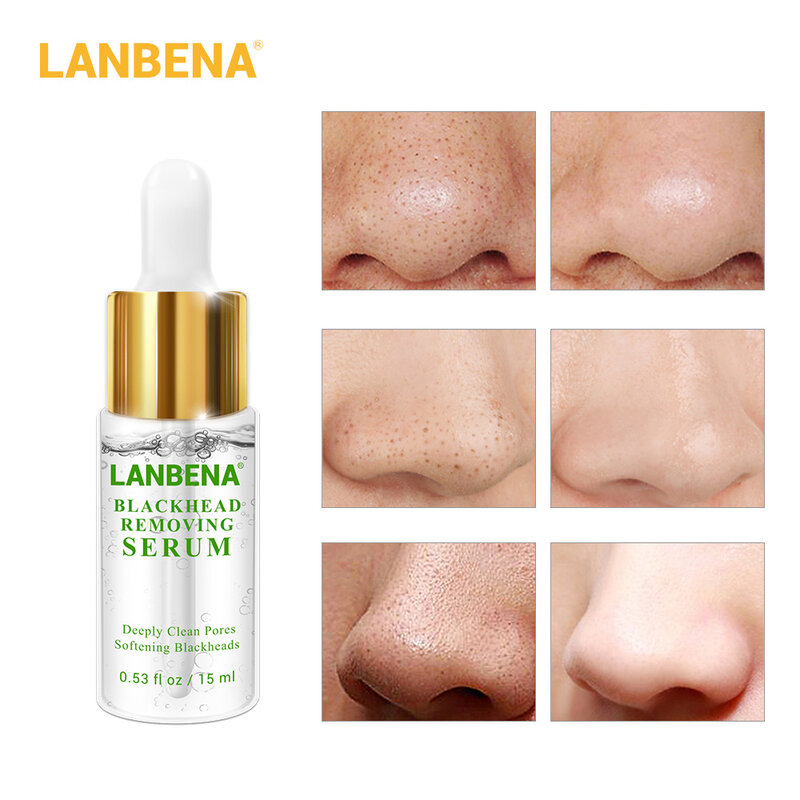 LANBENA Blackhead Removing Serum Deep Pore Acne Pimple Gentle removal Acne Treatment Shrink Pores Purifying Skin Care 15m