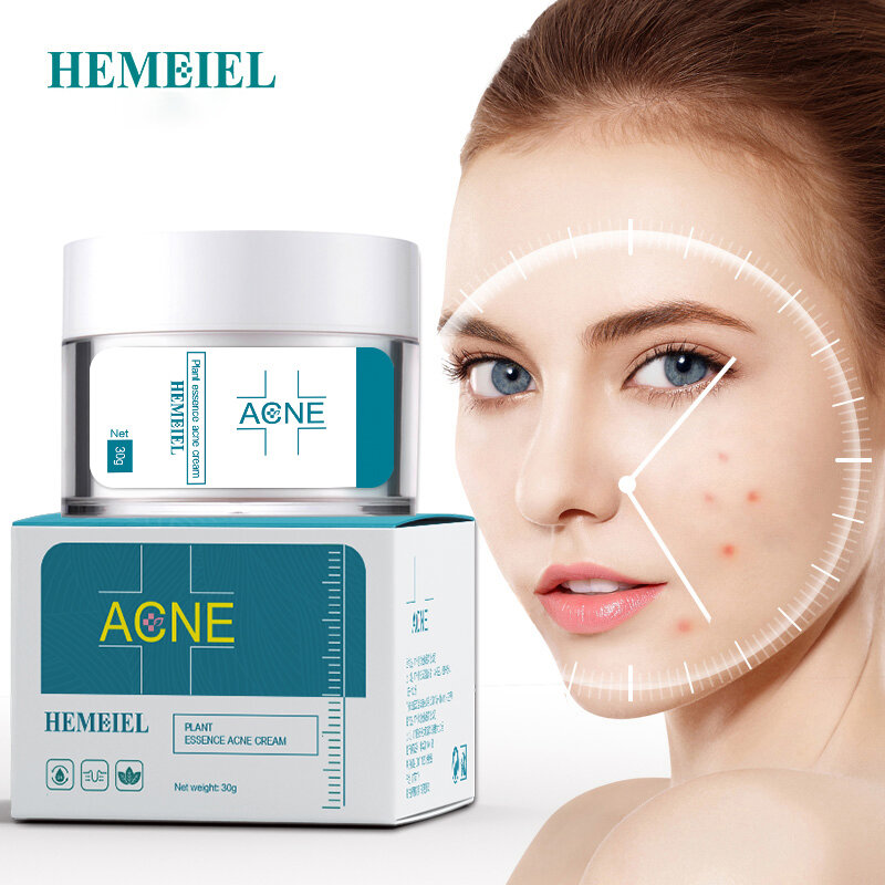 Hemeiel-Crema para el acné, tratamiento antigranos, manchas, acné, eliminación de cicatrices y espinillas, crema blanqueadora para el cuidado de la piel