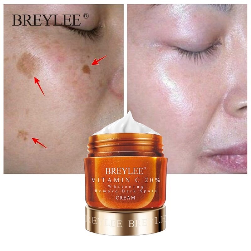 BREYLEE-crema Facial con vitamina C 20%, blanqueadora, elimina manchas oscuras, repara pecas, elimina melanina, ilumina la piel, 40g