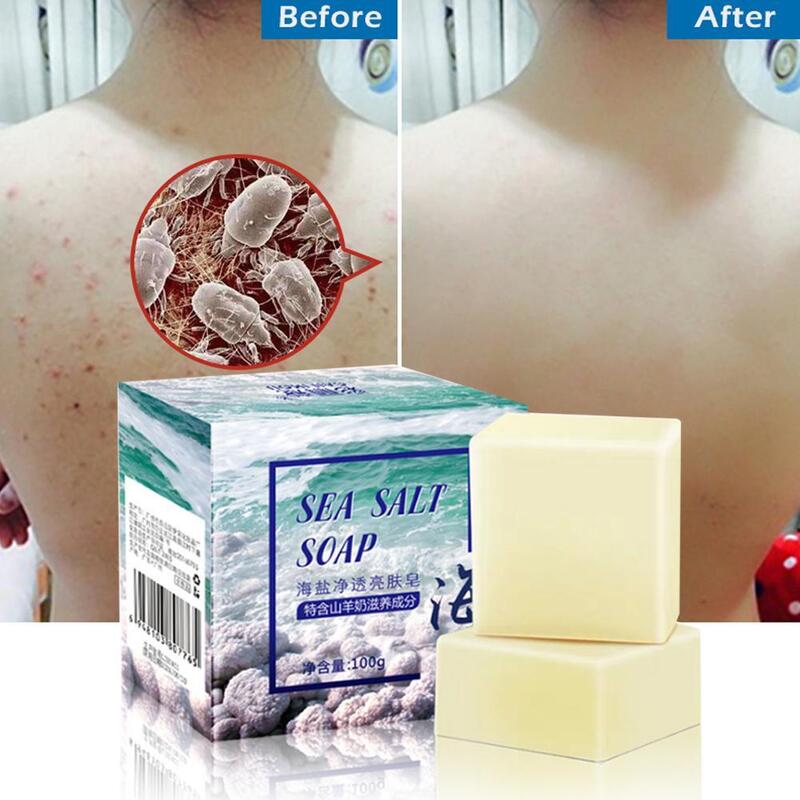 100g Sea Salt Soap whitening Moisturizing Wash Base Removal Face Acne Pimple Skin Care Treatment Face Wash Handmade Soap