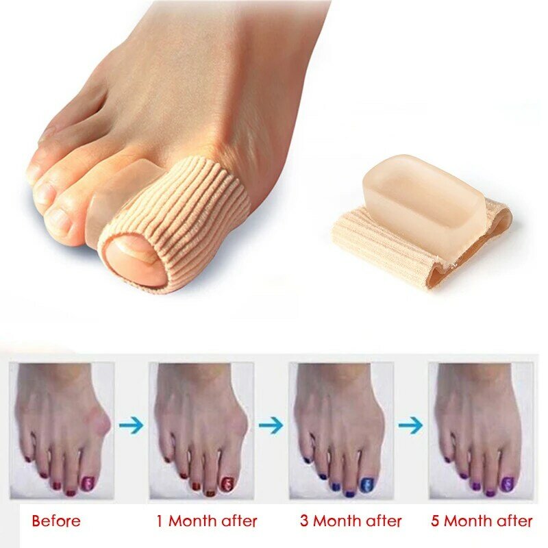 Alisador de dedos de los pies, almohadilla de silicona suave para juanetes, separador de dolor de pies, herramienta para el cuidado de los pies, 1 par