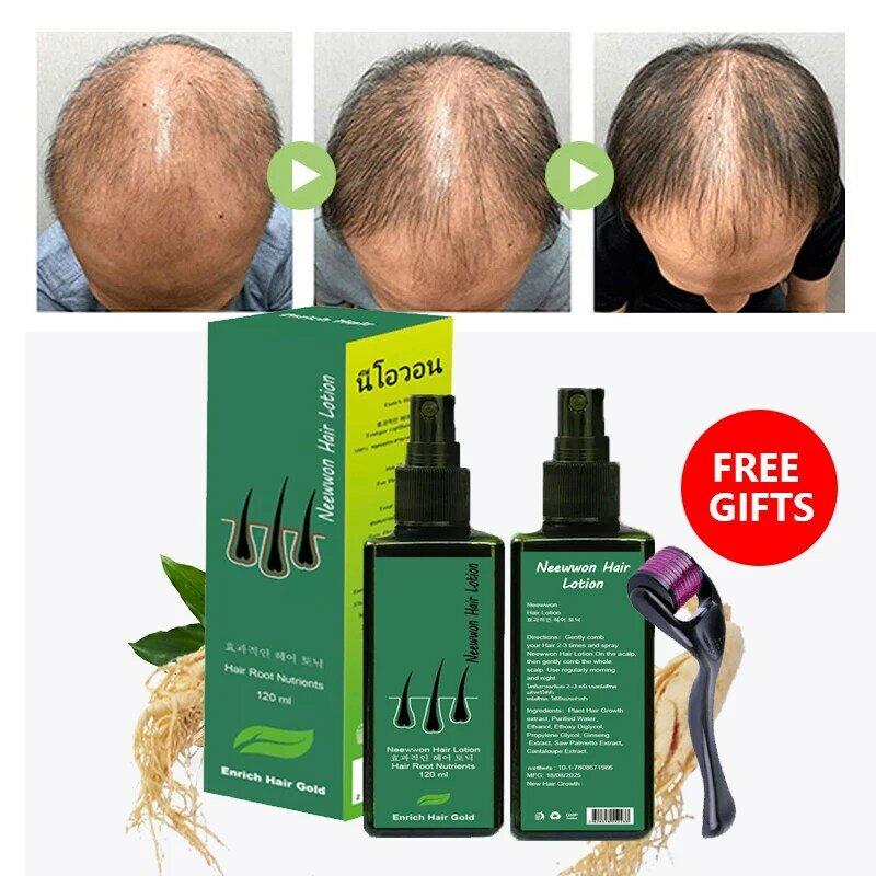 NEO Loción para el crecimiento del cabello, Tratamiento capilar, productos para el cuidado del cabello, nutrientes de raíz, antipérdida, rebrote, receta de Tailandia